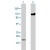 1 : His-tagged SARS-CoV spike protein gp24.
2 : His-tagged SARS-CoV spike protein gp120.
