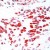 Human placenta stained with MMP2 monoclonal antibody, clone SPM346 ( Cat # MAB2541 ) at 1 : 50 for 10 min at RT. Staining of formalin-fixed tissue requires boiling tissue sections in 10 mM Citrate Buffer, pH 6.0 for 10 min followed by colling at RT for 20 min.