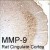MMP-9