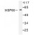 Western Blot: HSP60/HSPD1 antibody (T547) [NB100-91819] - in extracts from COLO205 cells.
