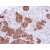 Immunohistochemistry: S100A11 Antibody [NBP1-32998] - Immunohistochemical analysis of paraffin-embedded SW480 Xenograft, using NBP1-32998.