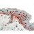 Immunohistochemistry-Paraffin: 14-3-3 sigma/Stratifin  Antibody [NB100-2465] - (2.5ug/ml) staining of paraffin embedded Human Skin. Steamed antigen retrieval with citrate buffer pH 6, AP-staining.