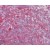 Immunohistochemistry-Paraffin: Hsp60 Antibody (Mab-11-13) [NBP1-19310] - Human spleen tissue stained with HSP60, mAb (Mab11-13) at 5ug/ml.