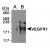 Western Blot: VEGFR1 Antibody [NB100-527] - Western Blot on VEGFR1 (A) empty vector control and (B) overexpression lysates [NBL1-06699].