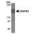 Western Blot: VEGFR1/VEGFR2 Antibody [NB100-527] - Western Blot on VEGFR2 overexpression lysates.