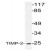 Western Blot: TIMP2 Antibody [NB100-92000] - Western blot (WB) analysis of TIMP2 (A47) pAb in extracts from A549 cells.