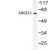 Western Blot: ABCD1 Antibody [NBP1-00700] - Western blot (WB) analysis of ABCD1 (D575)   antibody in extracts from Jurkat cell
