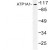 Western Blot: ATP1A1 Antibody [NBP1-00720] - Western blot (WB) analysis of ATP1A1 (G19) antibody in extracts from HeLa cells.