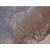 Immunohistochemistry: Cytokeratin 10+13 Antibody (DE-K13) [NB120-9383] - Fig. 1. Immunohistochemistry staining of tonsil (paraffin-embedded sections) with anti-Cytokeratin 10+13, (DE-K13). The antibody DE-K13 stains only Cytokeratin 13 when used on formalin-fixed, paraffin-embedded tissue sections.
