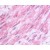 Vascular smooth muscle