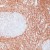 Formalin-fixed, paraffin-embedded human tonsil stained with (NB 200-572) using peroxidase-conjugate and DAB chromogen. Note absence of staining of reactive cells in the germinal center.