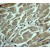 Immunohistochemistry: Asparagine Synthetase Antibody (EP282Y) [NB110-55470] - Immunohistochemical analysis of paraffin-enbedded human muscle tissue using anti-Asparagine Synthetase