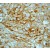 Immunohistochemistry: Cytokeratin 14 Antibody (EP1612Y) [NB110-56907] - Immunohistochemical analysis of paraffin-embedded human squamous lung carcinoma using anti-CK-14