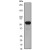 Western Blot: Cytokeratin 5 (C-term) Antibody (EP1601Y) [NB110-56916] - Western blot analysis on A431 cell lysate using anti-CK-5 (cat. # 110-56916), dilution1:10,000