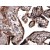 Formalin fixed and paraffin embedded normal human placenta tissue is subjected to mouse anti human TIMP-2