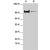 Western blot analysis of STAT2 polyclonal antibody ( Cat # PAB0831 ) in expression in A-431 ( A ) and HeLa ( B ) whole cell lysates.