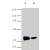 Western blot analysis of polyhistidine tagged recombinant HIS at 0.1 µg ( A ) and 0.01 µg ( B ) .