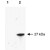 Western blot of RFP recombinant protein detected with RFP polyclonal antibody ( Cat # PAB11376 ).
Lane 1 shows no reaction against a GFP recombinant protein present in 10 µg of HeLa cell extract.
Lane 2 shows a single band detected in 10 µg of a HeLa lysate containing RFP recombinant protein as a 27 kDa band.
A 4-12% Bis-Tris gradient gel ( Invitrogen ) was used for SDS-PAGE. The membrane was blocked and then probed with RFP polyclonal antibody ( Cat # PAB11376 ) diluted 1:2,500 for 1 h at RT.