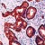 Immunohistochemical staining of KRT19 on formalin fixed, paraffin embedded human skin with KRT19 polyclonal antibody.