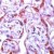 Immunohistochemical staining of MMP1 on formalin fixed, paraffin embedded human placenta with MMP1 polyclonal antibody.
