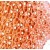 Immunohistochemical staining of KRT14 on formalin fixed, paraffin embedded human skin with KRT14 polyclonal antibody.