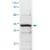 The cell lysate derived from HeLa was immunoblotted by AKT2 polyclonal antibody ( Cat # PAB12651 ) at 1 : 500.
