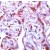 Human placenta stained with MMP1 polyclonal antibody ( Cat # PAB12708 ) at 1 : 100 for 10 min at RT. Staining of formalin-fixed tissue requires boiling tissue sections in 10 mM Citrate Buffer, pH 6.0 for 10 min followed by cooling at RT for 20 min.