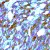 Human melanoma stained with S100A1 polyclonal antibody ( Cat # PAB12732 ) at 1 : 300 for 10 min at RT. Staining of formalin-fixed tissue requires boiling tissue sections in 10 mM Citrate Buffer, pH 6.0 for 10 min followed by cooling at RT for 20 min.