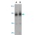 Western blot analysis of AKT1 in human liver tissue lysate with AKT1 polyclonal antibody ( Cat # PAB12948 ) at ( A ) 1 and ( B ) 2 µg/ml.