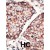 Formalin-fixed and paraffin-embedded human cancer tissue reacted with MMP3 polyclonal antibody ( Cat # PAB4795 ) , which was peroxidase-conjugated to the secondary antibody, followed by AEC staining. This data demonstrates the use of this antibody for immunohistochemistry ; clinical relevance has not been evaluated. HC = hepatocarcinoma.