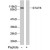 Western blot analysis of extract from HeLa cells, using STAT6 polyclonal antibody ( Cat # PAB7636 ).