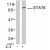 Western blot analysis of extract from HeLa cells, using STAT6 (phospho Y641) polyclonal antibody ( Cat # PAB7710 ).