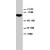 Western blot analysis of human colon cancer lysate. Using STAT1 polyclonal antibody ( Cat # PAB8012 ) .