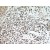 Immunohistochemistry of paraffin-embedded Gliomas using 10373-2-AP(MMP2 Antibody) at Dilution 1:50 (under 10x lens)