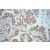 Immunohistochemistry of paraffin-embedded Lung cancer using 10858-1-AP(Timp-3 Antibody) at Dilution 1:50 (under 10x lens)