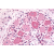 Immunhistochemistry analysis in human spinal cord / dorsal root ganglion (Formalin-fixed, Paraffin-embedded) using Serotonin receptor 1D (HTR1D) antibody Cat.-No. SP4689P (N-term).