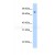 STAT1