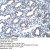 Cytokeratin 18
