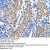 17-beta-HSD1 / HSD17B1