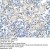 Cytokeratin 17