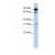 ABCD4 / PXMP1L