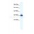 Serotonin receptor 1B (HTR1B)