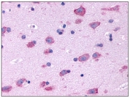 SP4047P - Serotonin receptor 2B (HTR2B)