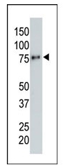 AM11008SU-N - HA Epitope Tag (YPYDVPDYA)