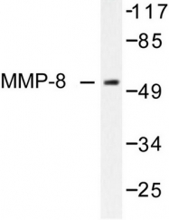 AP06235PU-N - MMP-8