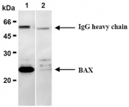 AM20182AF-N - Bax