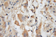 12391-1-AP - Carbonic anhydrase 8
