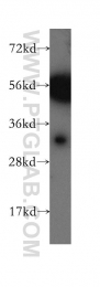 12391-1-AP - Carbonic anhydrase 8