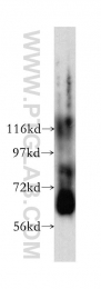 51008-2-AP - ABCE1