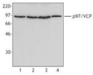 AM08335PU-M - TER ATPase / VCP